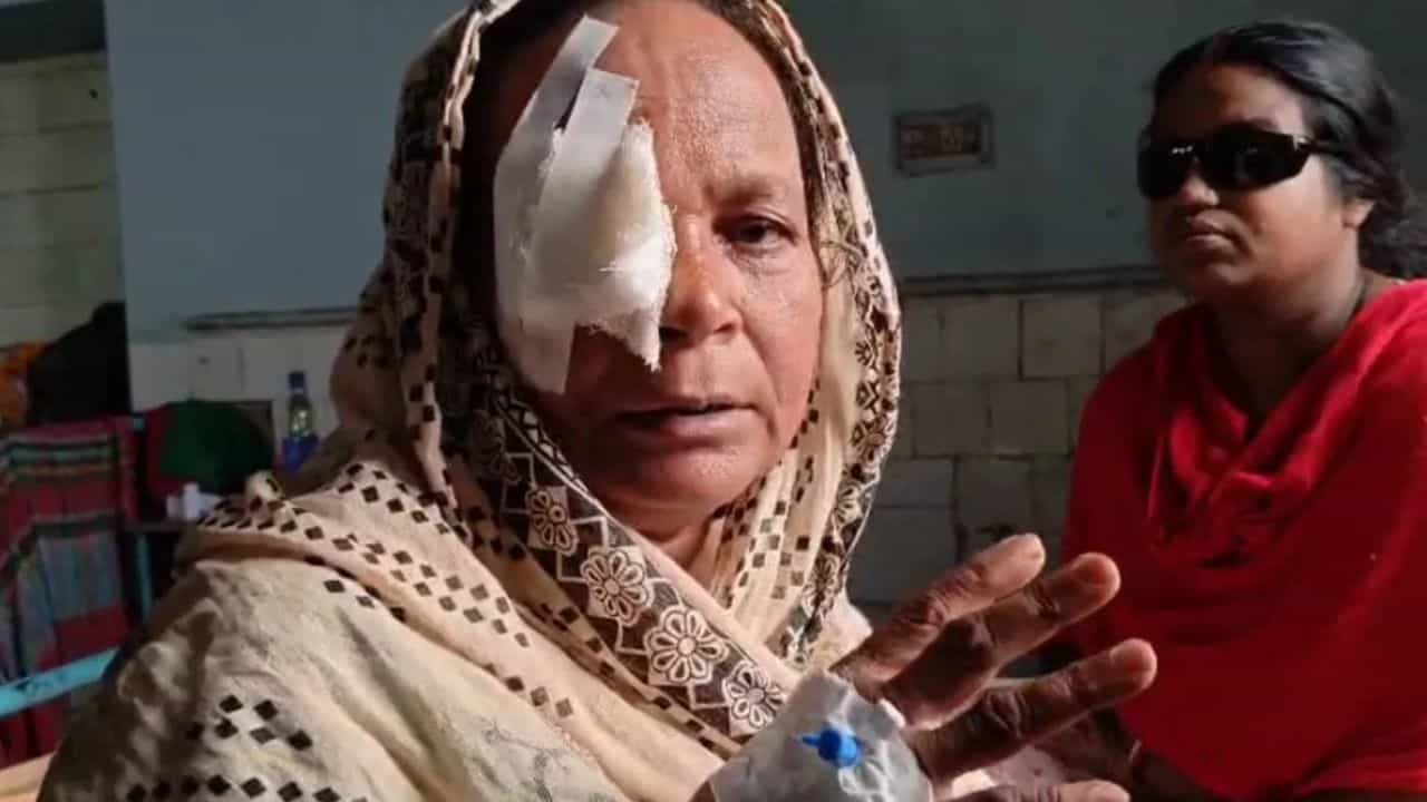 Cataract Operation: ছানি কাটাতে গিয়ে এ কেমন বিপত্তি? স্বাস্থ্য ভবন বসল বৈঠকে Cataract Operation: ছানি কাটাতে গিয়ে এ কেমন বিপত্তি? স্বাস্থ্য ভবন বসল বৈঠকে