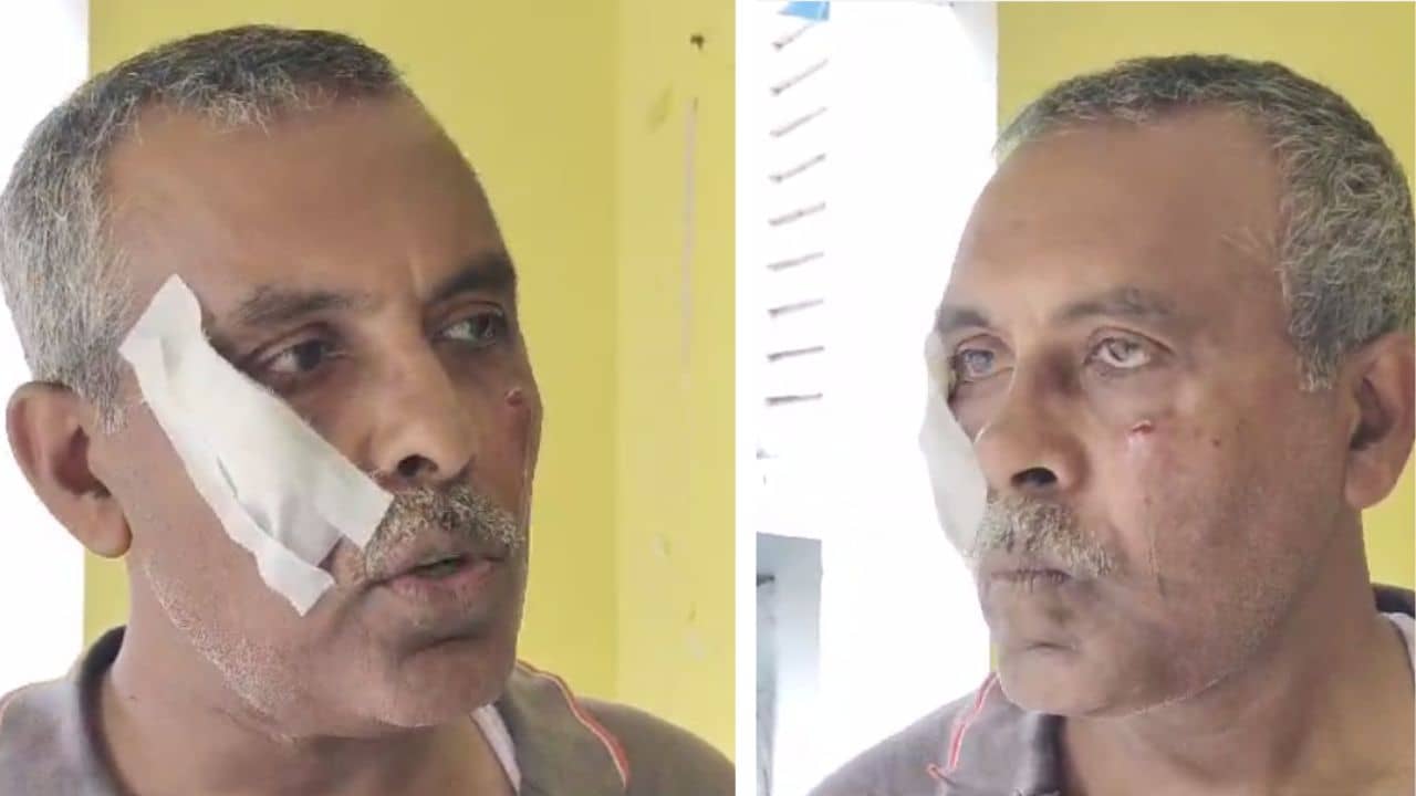 Gandhi Memorial Hospital: সরকারি হাসপাতালে ভাইকে দেখতে গিয়ে জুটল মার, গুরুতর আহত ডেপুটি ম্যাজিস্ট্রেট