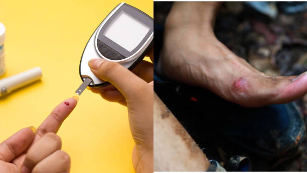 Diabetes Neuropathy: রোজই কাদা, বৃষ্টির জল পেরোতে হচ্ছে? ডায়াবেটিসের রোগীরা কিন্তু সাবধান!