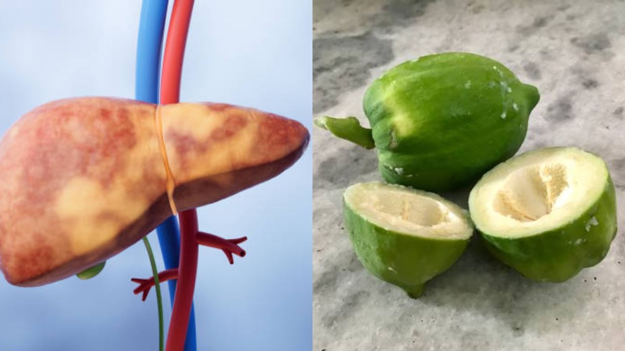 Vegetables for Fatty Liver: কাঁচা পেঁপে খেলে কি ফ্যাটি লিভারের সমস্যা কমবে? খাওয়ার আগে জানুন