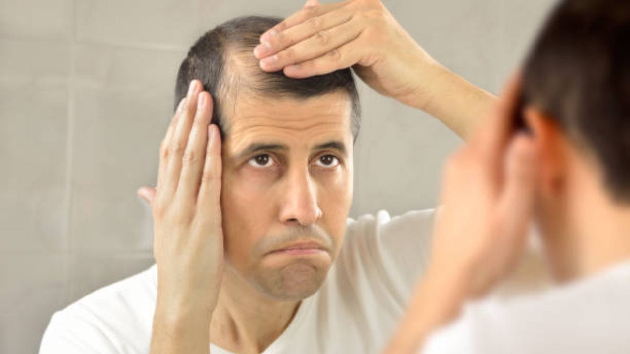 Hair Care For Men: ৩০ পেরোনোর আগেই মাথায় টাক? এই টিপসে ছেলেদের চুল ...