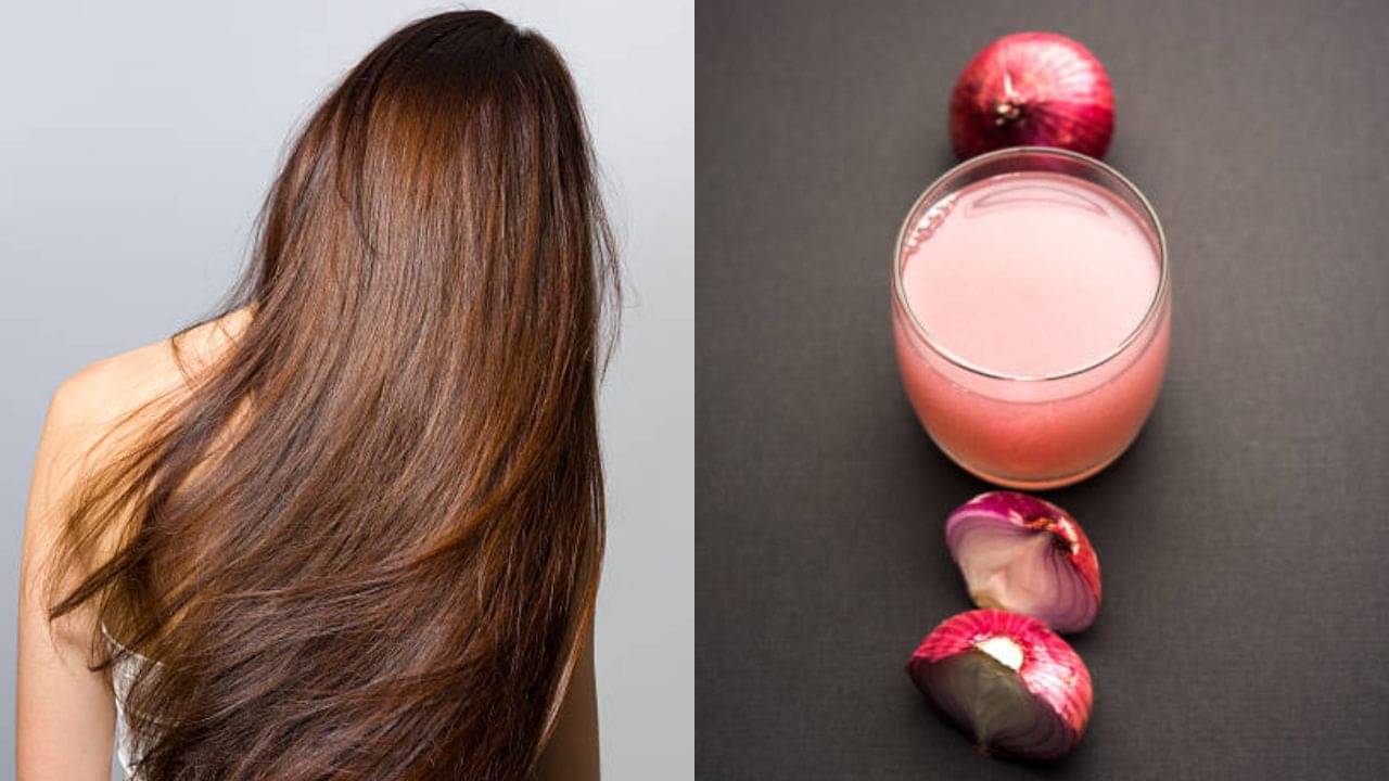 Onion for Hair: দিন দিন চুল পাতলা হয়ে যাচ্ছে? এক সপ্তাহ টাকে পেঁয়াজের রস মেখে নিজেই তফাৎ দেখুন