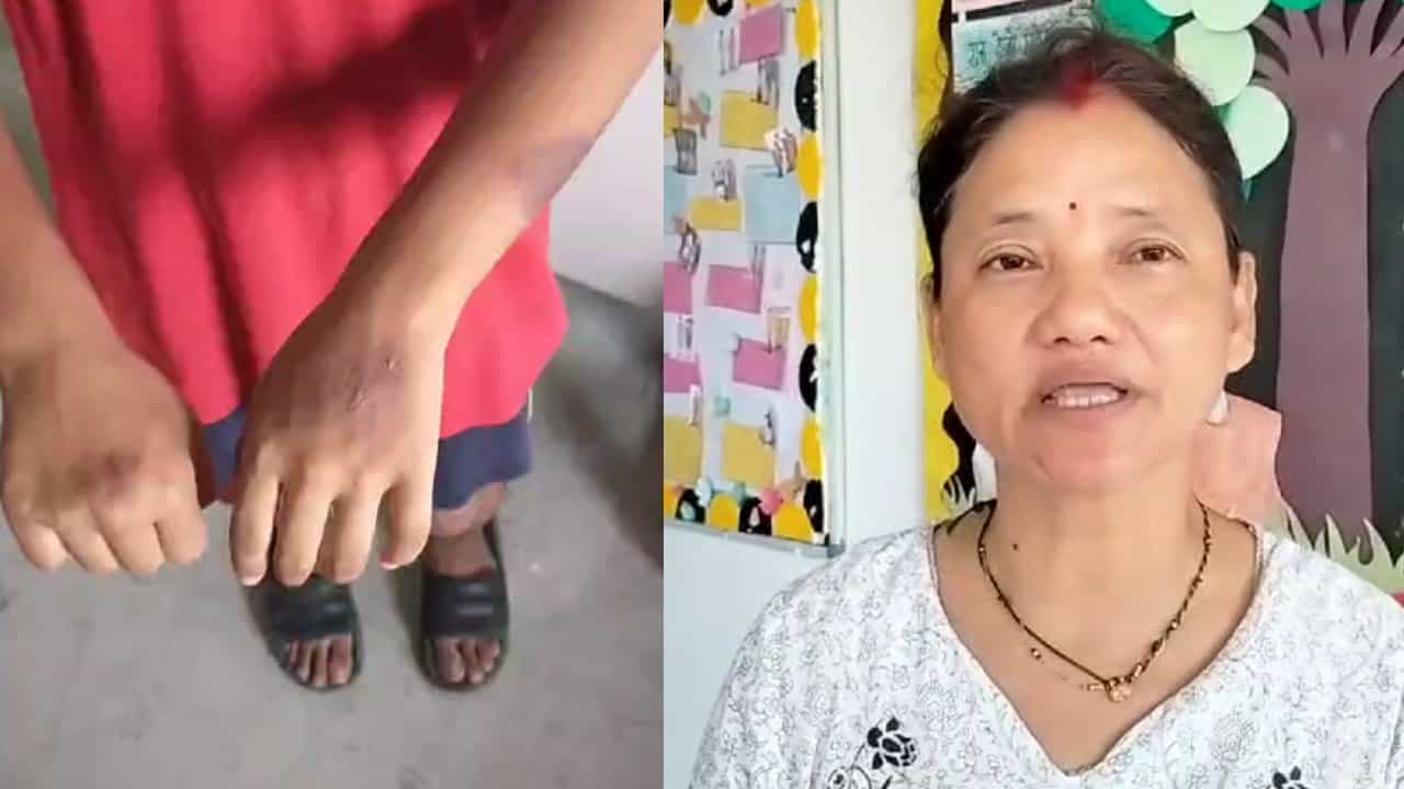 Dhupguri: গরম হাতা দিয়ে খুদের হাতে ছ্যাঁকা প্রিন্সিপালের, চাপের মুখে বললেন, ‘আমার ভুল হয়েছে’ Dhupguri: গরম হাতা দিয়ে খুদের হাতে ছ্যাঁকা প্রিন্সিপালের, চাপের মুখে বললেন, ‘আমার ভুল হয়েছে’