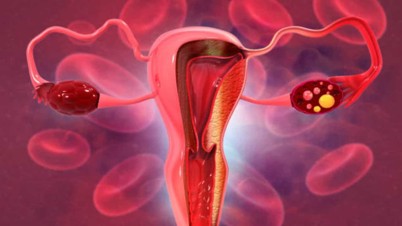 Irregular Periods: মাসে দু’বার ঋতুস্রাব হচ্ছে, শরীরে কোনও রোগ বাসা বেঁধেছে নাকি এটা স্বাভাবিক? Irregular Periods: মাসে দু’বার ঋতুস্রাব হচ্ছে, শরীরে কোনও রোগ বাসা বেঁধেছে নাকি এটা স্বাভাবিক?