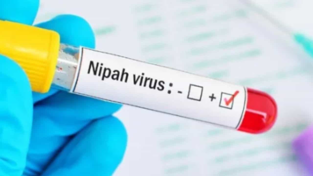 Nipah Virus: এ বছর কেরলে নিপা ভাইরাসে দ্বিতীয় মৃত্যু, প্রাণ গেল ২৪ বছরের যুবকের Nipah Virus: এ বছর কেরলে নিপা ভাইরাসে দ্বিতীয় মৃত্যু, প্রাণ গেল ২৪ বছরের যুবকের