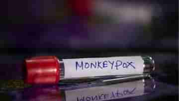 Monkeypox clade 1: প্রথমবার ভারতে মাঙ্কিপক্সের ক্লাড ১ স্ট্রেনের হদিশ