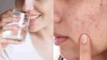 Skin Hydration: ব্রণ নিয়ে বিরক্ত? শুধু জল খেয়েই তাড়ান ত্বকের এই সমস্যা