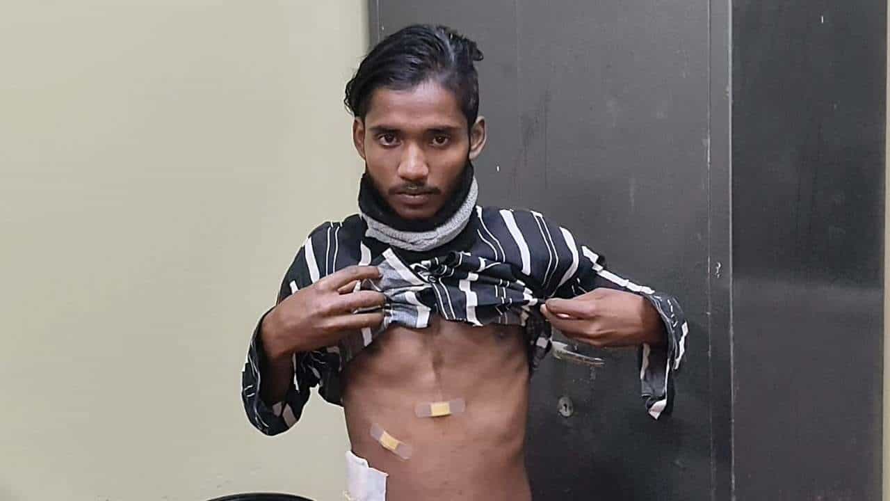 Balurghat: খাদ্যনালীতে ফুটো! জটিল অস্ত্রোপচারেই কামাল, যমের দুয়ার থেকে রোগীকে ফিরিয়ে আনলেন বাংলার ডাক্তারেরা Balurghat: খাদ্যনালীতে ফুটো! জটিল অস্ত্রোপচারেই কামাল, যমের দুয়ার থেকে রোগীকে ফিরিয়ে আনলেন বাংলার ডাক্তারেরা