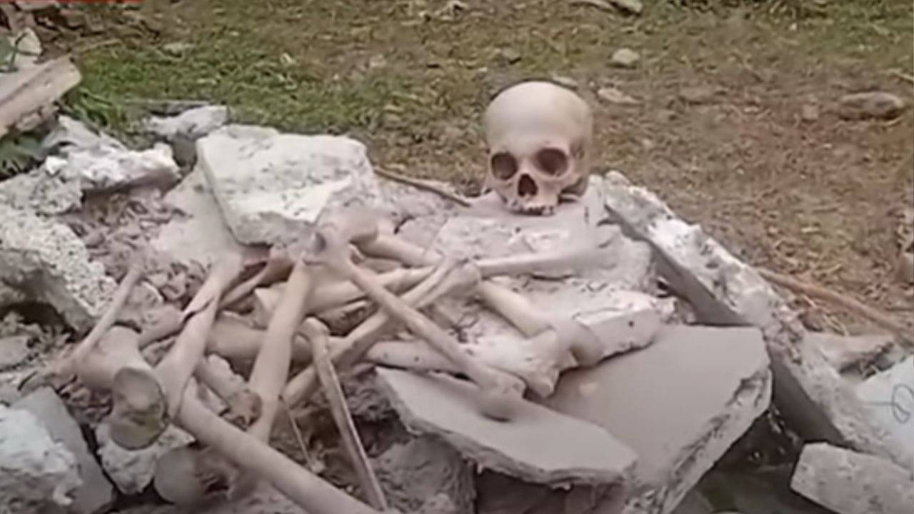 Beleghata: বেলেঘাটা আইডি-র মর্গের সামনে পড়ে খুলি-হাড়গোড়! রহস্য ঘনীভূত