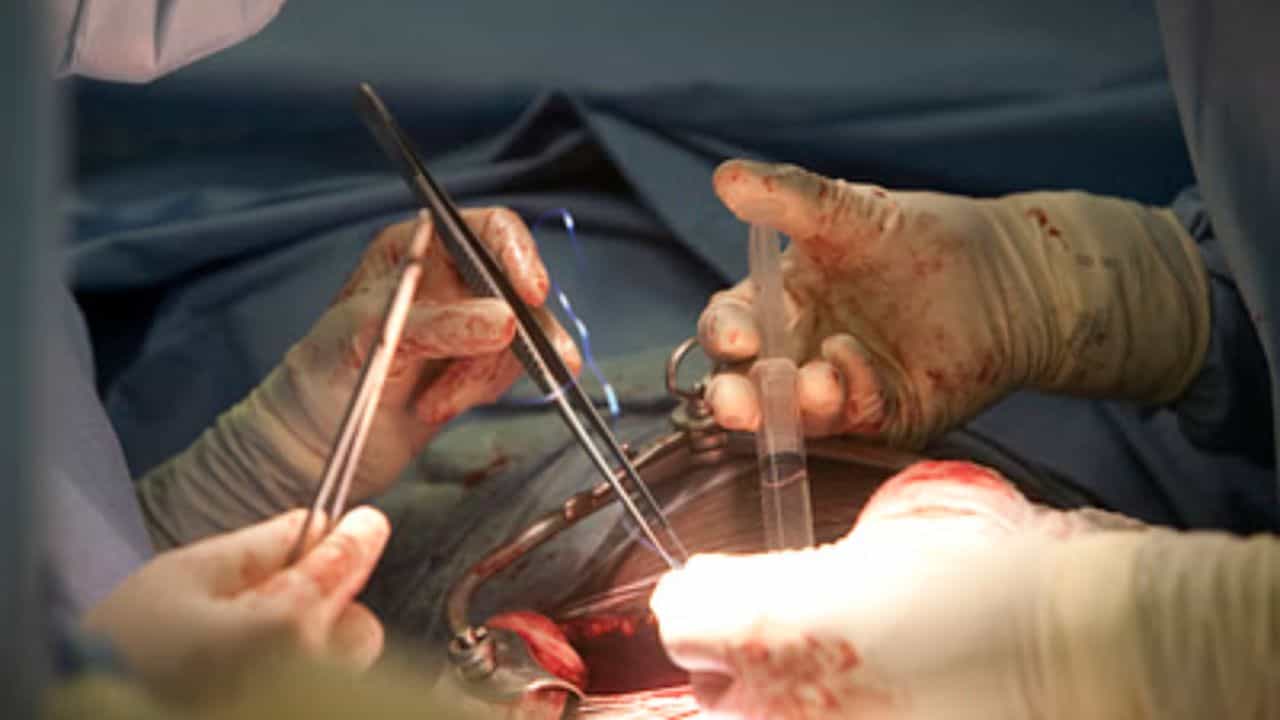 Scalp Surgery: ফ্যানে চুল জড়িয়ে রক্তারক্তি অবস্থা, ১৩ বছরের মেয়ের মাথায় ৮ ঘণ্টার অপারেশন! তারপর... Scalp Surgery: ফ্যানে চুল জড়িয়ে রক্তারক্তি অবস্থা, ১৩ বছরের মেয়ের মাথায় ৮ ঘণ্টার অপারেশন! তারপর...