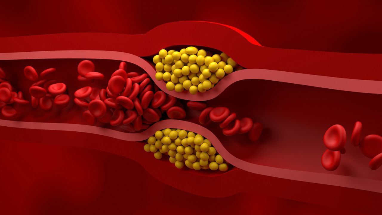 Cholesterol: সকাল সকাল এই ৬ অভ্যাস মানলে কোলেরেস্টেরল থাকবে বশে, বলছেন বিশেষজ্ঞ