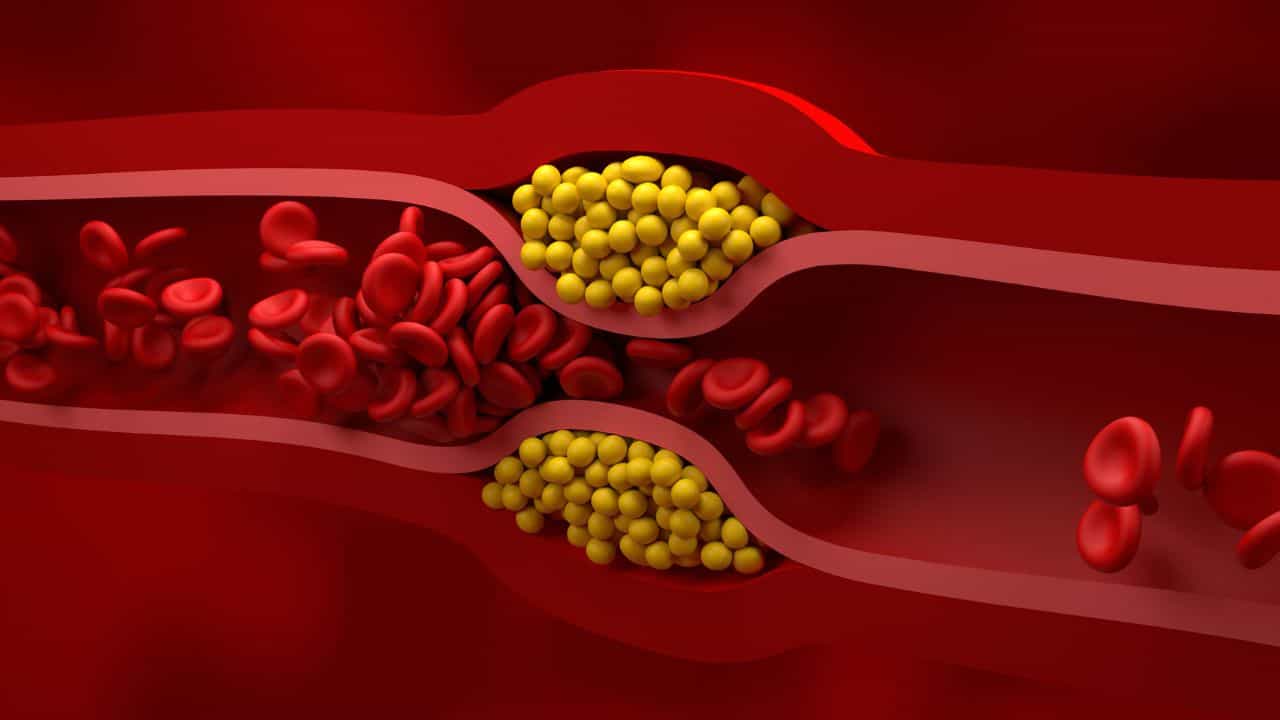Cholesterol: সকাল সকাল এই ৬ অভ্যাস মানলে কোলেরেস্টেরল থাকবে বশে, বলছেন বিশেষজ্ঞ Cholesterol: সকাল সকাল এই ৬ অভ্যাস মানলে কোলেরেস্টেরল থাকবে বশে, বলছেন বিশেষজ্ঞ