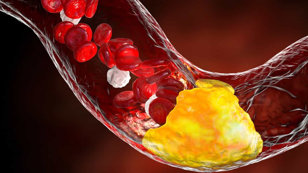 High Cholesterol: কোলেস্টেরলের সমস্যায় জেরবার? এই নিয়মে মাত্র ১ মাসেই বশ করুন তাকে High Cholesterol: কোলেস্টেরলের সমস্যায় জেরবার? এই নিয়মে মাত্র ১ মাসেই বশ করুন তাকে