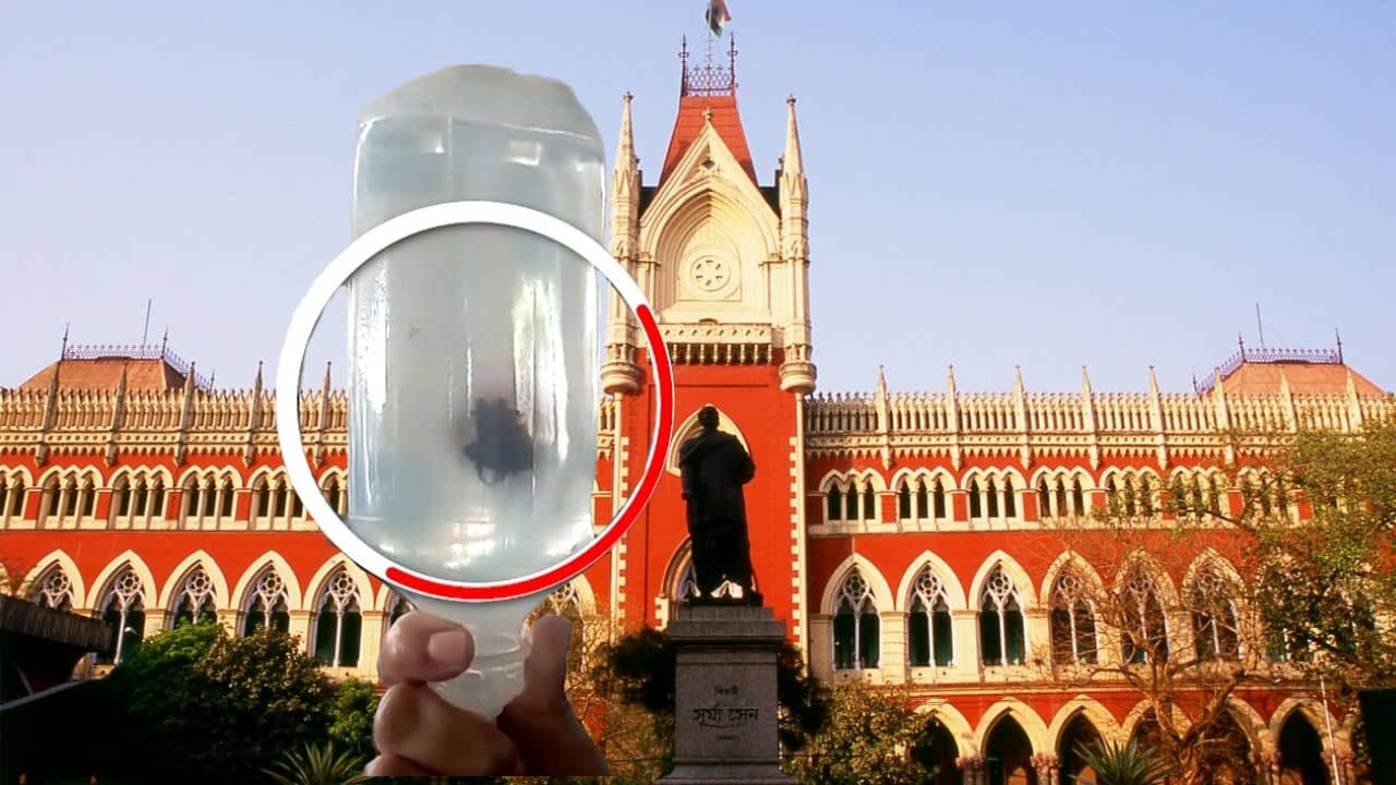 Calcutta High Court: এসএসকেএম-এ চলছে যমে-মানুষে লড়াই, আরএল নিয়ে এবার মামলা হাইকোর্টে