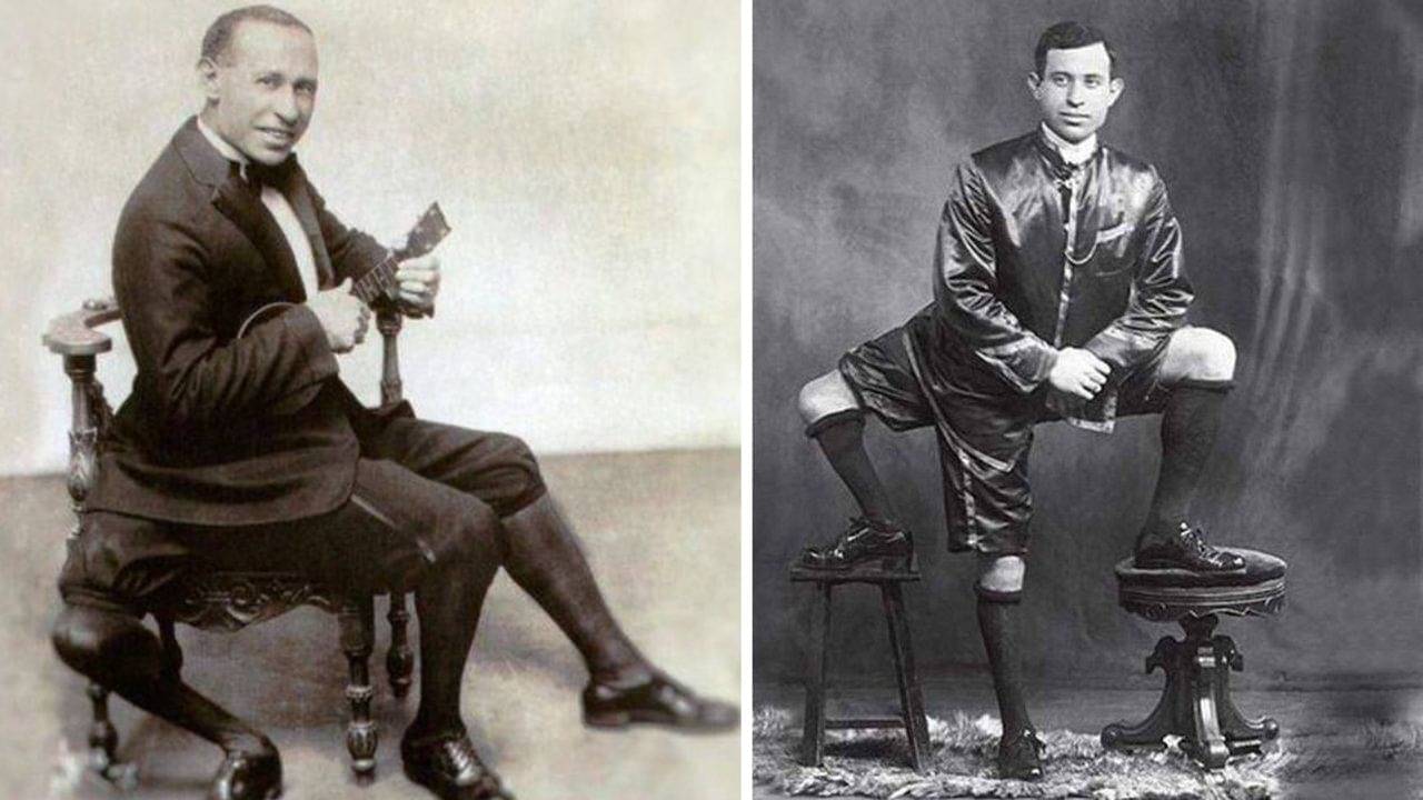 Frank Lentini: একটাই লোকের রয়েছে ২টি পুরুষাঙ্গ, ৩টি পা! দ্য কিং অব আমেরিকান সার্কাস কে চেনেন?