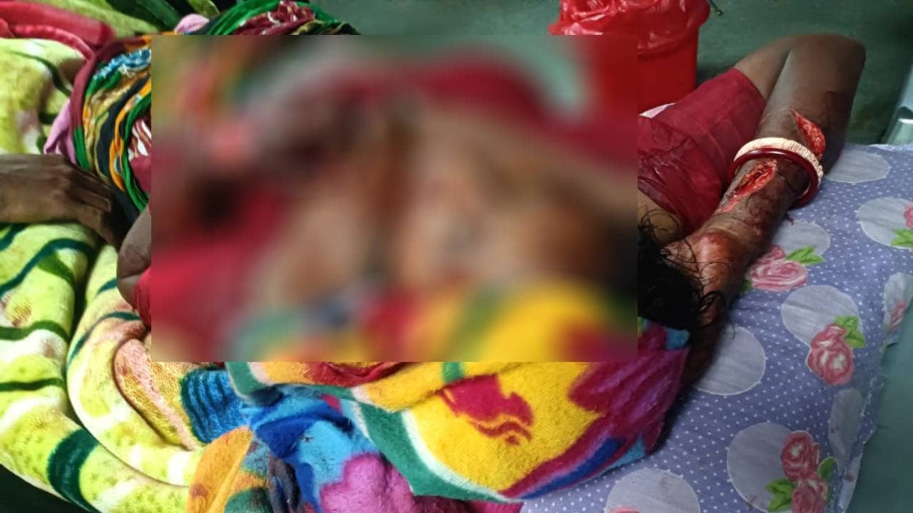 Egra: রাতের অন্ধকারে বাড়িতে ঢুকে পর পর কোপ, BJP কর্মীর স্ত্রীর অবস্থা দেখে শিউরে উঠল গোটা গ্রাম, কাঠগড়ায় তৃণমূল
