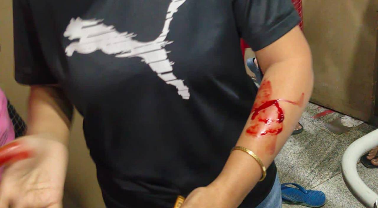 Kolkata: খাস কলকাতায় ভয়াবহ ঘটনা, প্রকাশ্য রাস্তায় কোপ মহিলা আইনজীবীকে