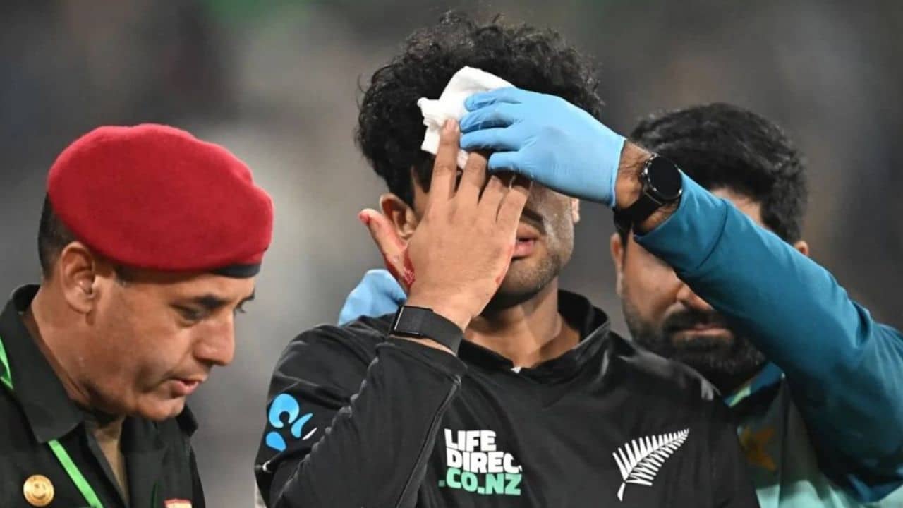 Rachin Ravindra: চ্যাম্পিয়ন্স ট্রফির আগে রক্তাক্ত অবস্থায় মাঠ ছাড়লেন রাচিন রবীন্দ্র, ক্রিকেটপ্রেমীদের নিশানায় PCB