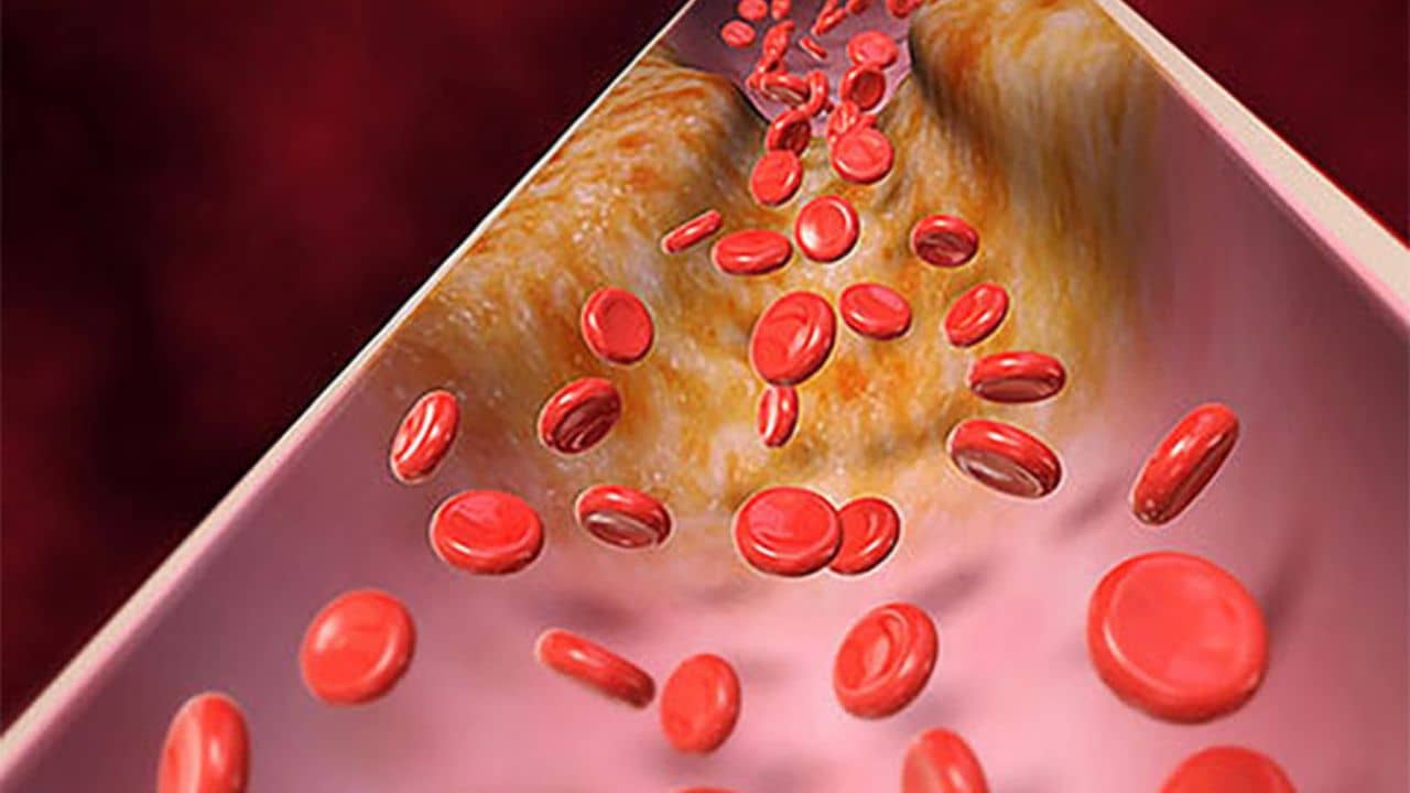 Bad Cholesterol: কোলেস্টেরল চোখ রাঙাচ্ছে? এই নিয়মে তাকে বলুন নো এন্ট্রি