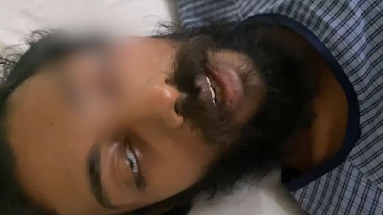 Jadavpur University: ছিঁড়ে গিয়েছে চোখের পাতা, সেদিন কীভাবে চলে গেল গাড়ির চাকাটা, নিজেই জানালেন যাদবপুরের ইন্দ্রানুজ