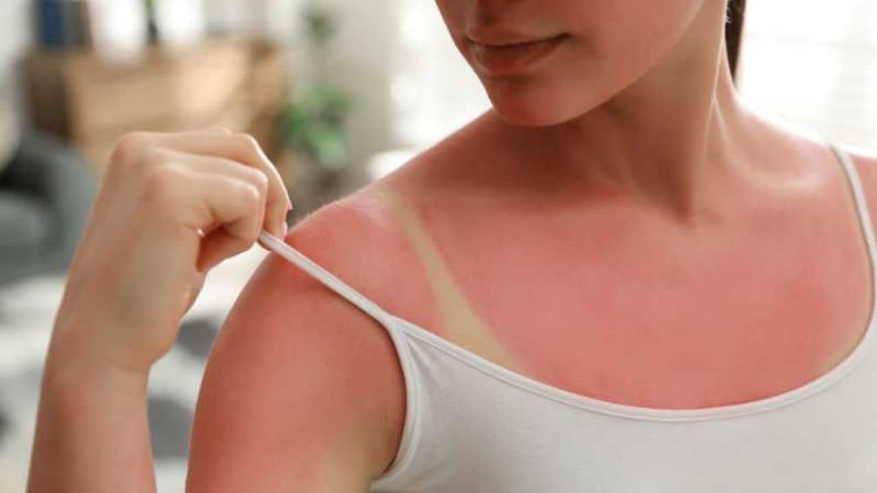 রোদে পুড়ে ত্বকের বারোটা বেজেছে? এক চামচ ময়দাই করবে কামাল