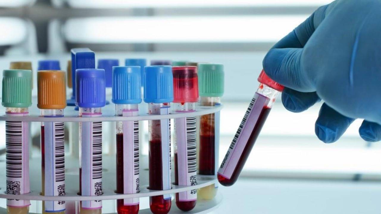 কীভাবে জানবেন আপনার রক্ত পাতলা না ঘন? ডাক্তার বলছেন...