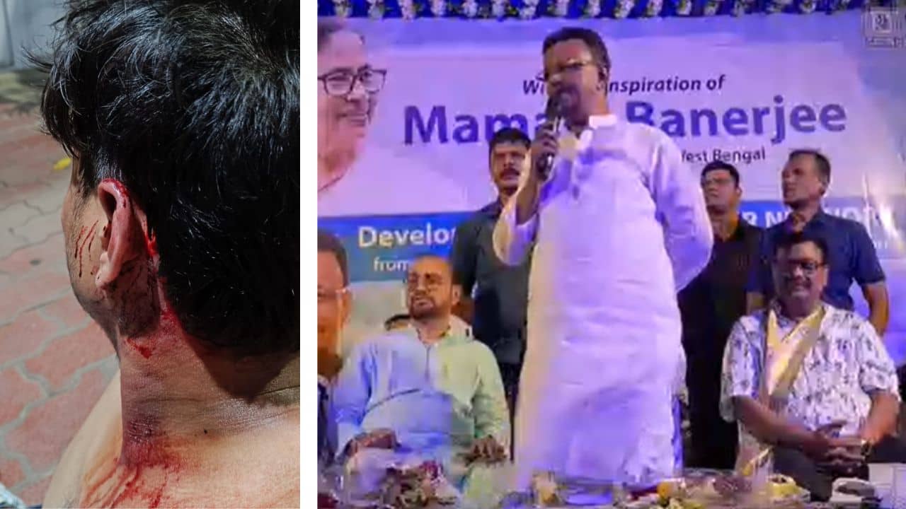 Firhad Hakim: ববিকে মালা পরানো নিয়ে ঝামেলা? মেয়রের সামনেই TMC-র দুই গোষ্ঠীর ঝামেলায় ফাটল মাথা, নেতারা বললেন, ধাক্কাধাক্কি হয়েছে