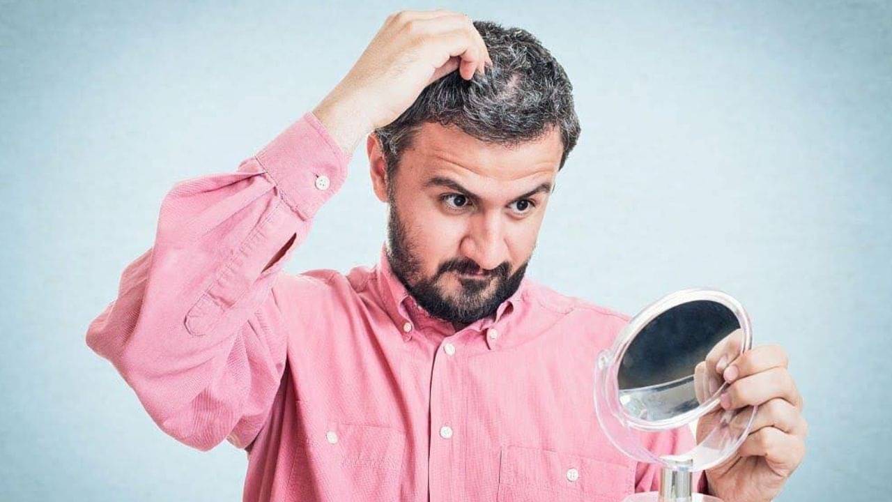 শরীরে এসব ঘটলেই অল্প বয়সে পাকবে চুল-দাড়ি, মাথা পুরোটা সাদা হওয়ার আগেই পড়ে নিন