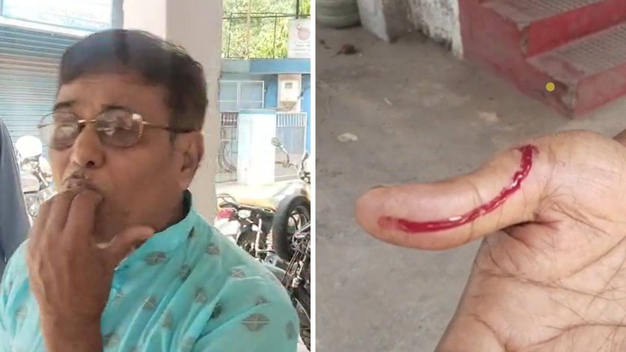 Hooghly: হাতে কামড়ে রক্ত বের করে দিল...! পয়লা বৈশাখের সকালে SBI এটিএমে রক্তারক্তি কাণ্ড
