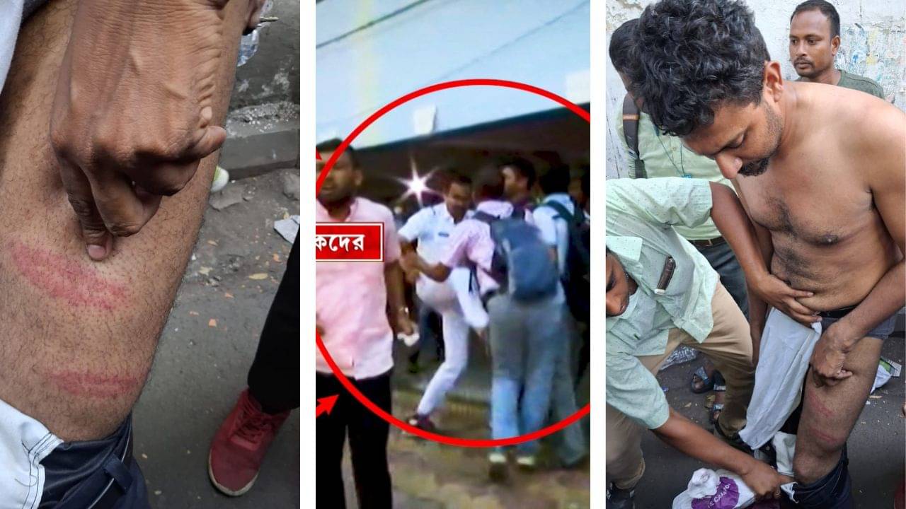 Sacked Teachers’ Movement: কমিশনার বলছেন মৃদু লাঠিচার্জ,জামা-প্যান্ট খুলে প্রমাণ দেখালেন চাকরিহারা শিক্ষক, আর্ত চিৎকার করে বললেন, আমাদের কষ্টটা বুঝুন...