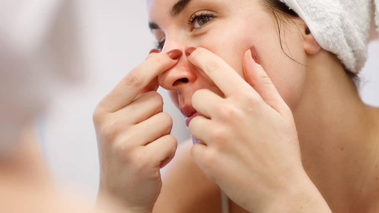 ব্রণ কেড়েছে রাতের ঘুম? ক্রিম কেনার আগে দেখে নিন এই উপাদান আছে তো!