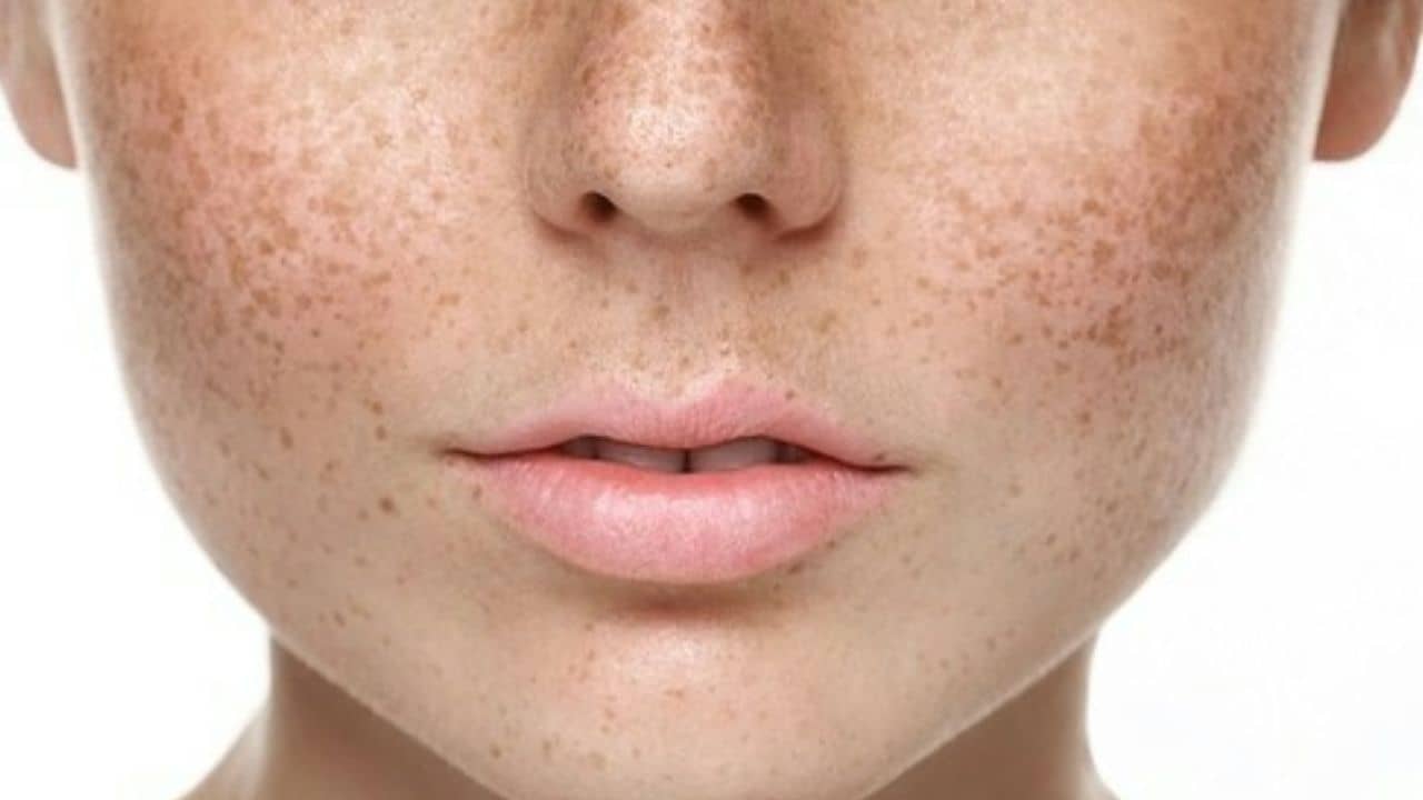 এই পানীয়তেই দূর হবে পিগমেন্টেশনের সমস্যা, বাড়িতেই বানিয়ে ফেলুন...