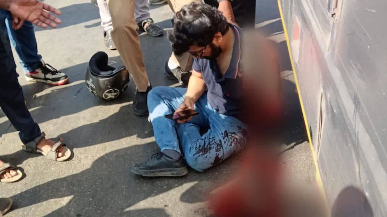 Accident: বাসের একেবারে সামনে হঠাৎ চলে এল বাইক, চাকায় এমনভাবে পিষল যে ছিঁড়ে পড়ে গেল হাত!