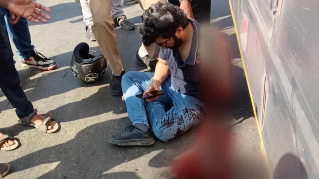 Accident: বাসের একেবারে সামনে হঠাৎ চলে এল বাইক, চাকায় এমনভাবে পিষল যে ছিঁড়ে পড়ে গেল হাত! Accident: বাসের একেবারে সামনে হঠাৎ চলে এল বাইক, চাকায় এমনভাবে পিষল যে ছিঁড়ে পড়ে গেল হাত!