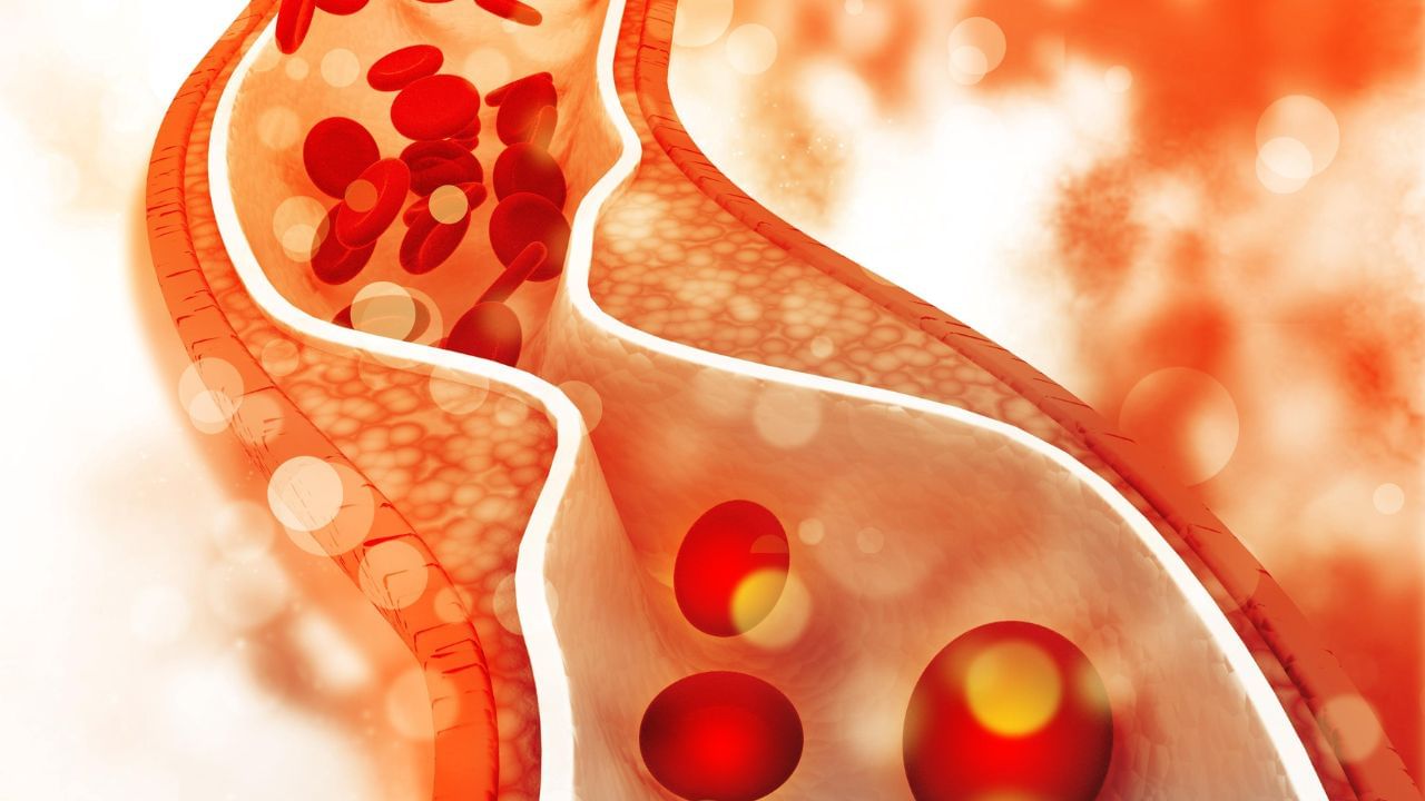 High Cholesterol: ২০ দিনে কমবে কোলেস্টেরল! জানুন এই ৪ উপায় High Cholesterol: ২০ দিনে কমবে কোলেস্টেরল! জানুন এই ৪ উপায়