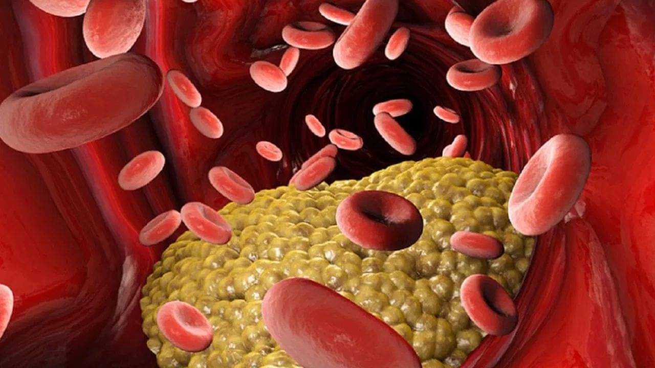 Cholesterol: কোলেস্টেরল কমাতে সঞ্জীবনীর সমান, রোজের ডায়েটে রাখুন এই খাবার!