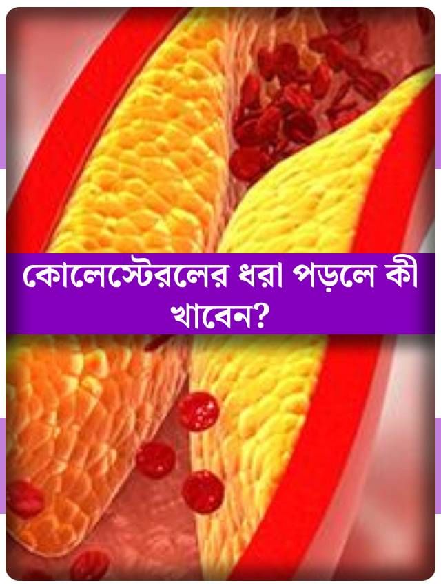 এই ৭ খাবারেই লেজ গুটিয়ে পালাবে কোলেস্টেরল! এই ৭ খাবারেই লেজ গুটিয়ে পালাবে কোলেস্টেরল!