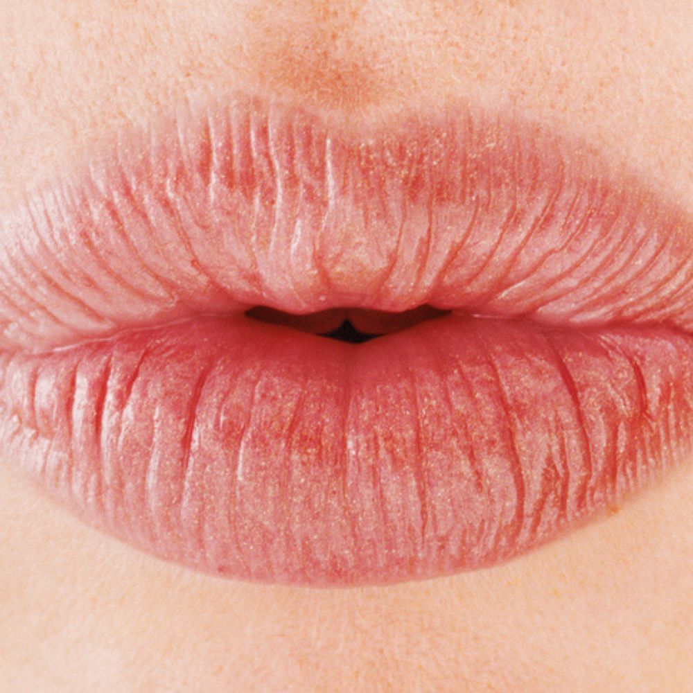 image of lips