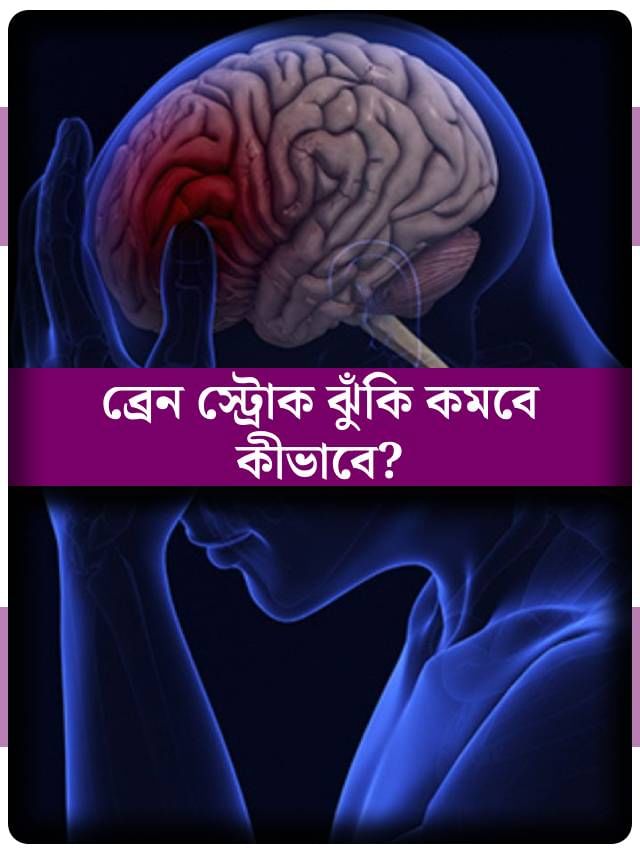 বয়সের সঙ্গে বাড়ে স্ট্রোকের ঝুঁকিও! কীভাবে তা নিয়ন্ত্রণে রাখবেন? বয়সের সঙ্গে বাড়ে স্ট্রোকের ঝুঁকিও! কীভাবে তা নিয়ন্ত্রণে রাখবেন?