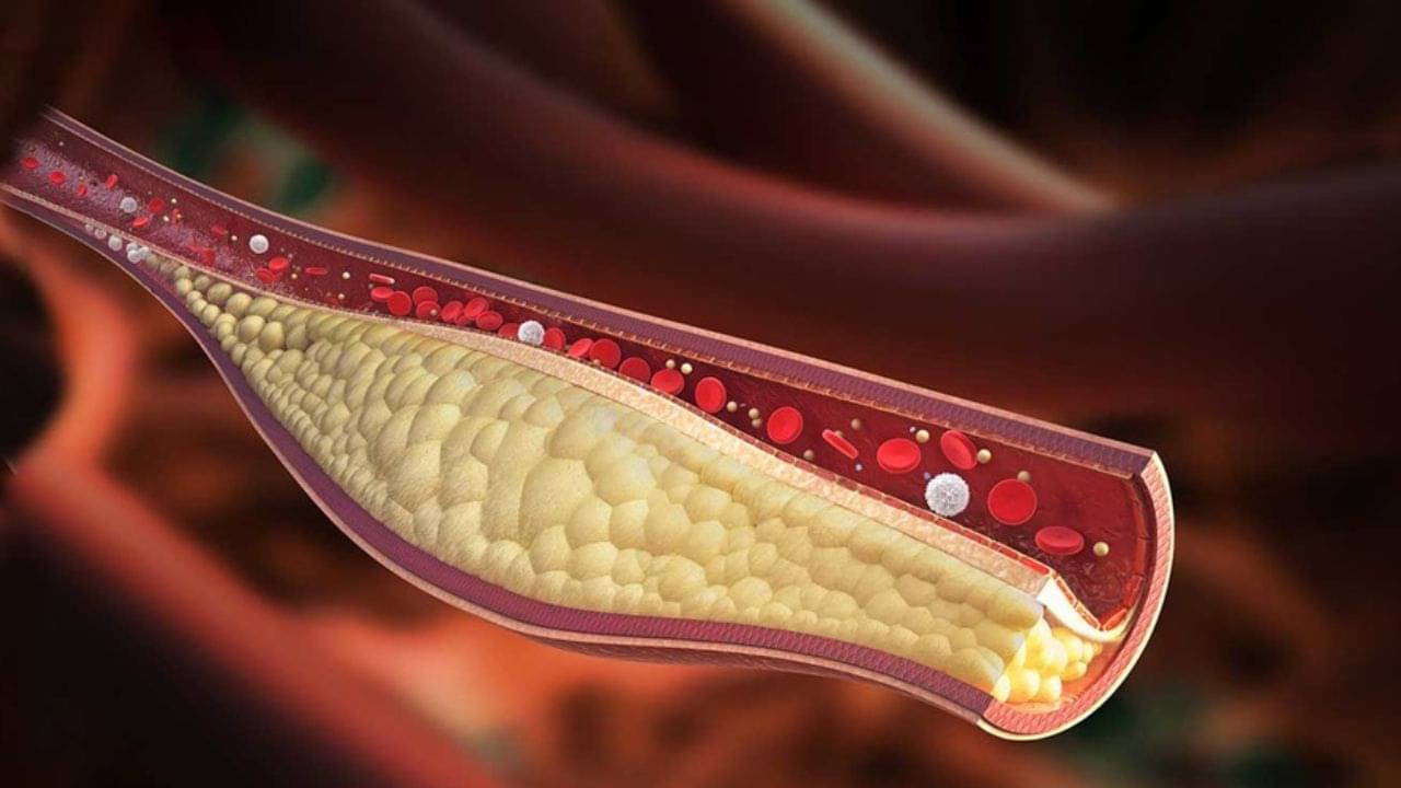 Cholesterol Diet: কোলেস্টেরলের যম এই ৭ ফল! ডায়েটে থাকলে ৭ দিনে মিলবে মুক্তি