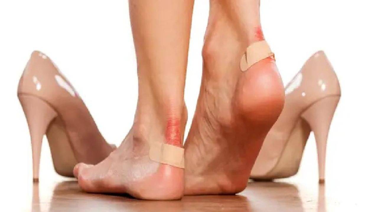 জুতো পরে পায়ে ফোসকা? এই সহজ টোটকাতেই সমস্যার সমাধান, রইল টিপস