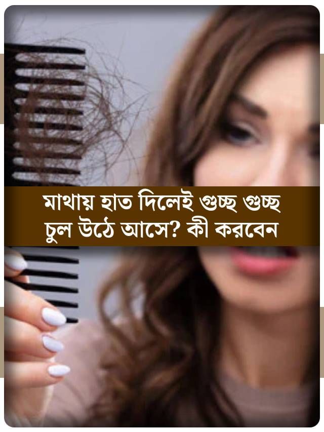 মাথায় হাত দিলেই উঠে আসে গুচ্ছ গুচ্ছ চুল? কী করলে বন্ধ হবে চুল পড়া? মাথায় হাত দিলেই উঠে আসে গুচ্ছ গুচ্ছ চুল? কী করলে বন্ধ হবে চুল পড়া?