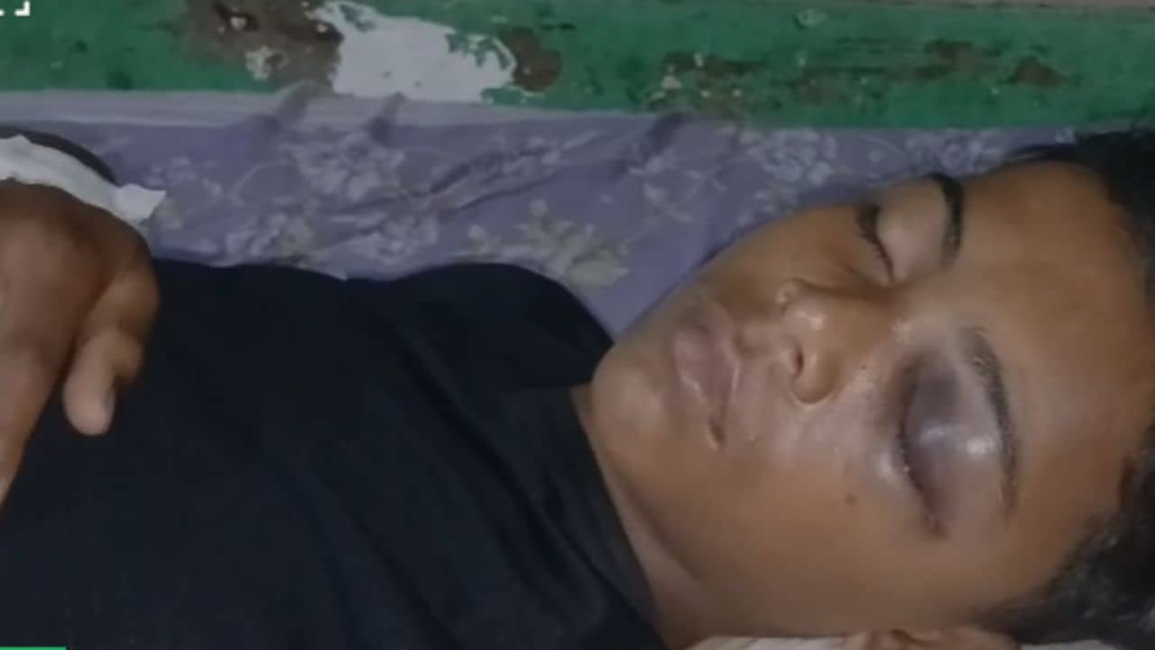 Konnagar: কখনও গলা কাটা, কখনও বেদম মার, এবার কোন্নগরে আমপাড়া নিয়ে কিশোরের সঙ্গে কী নৃশংস কাজ করা হল দেখুন