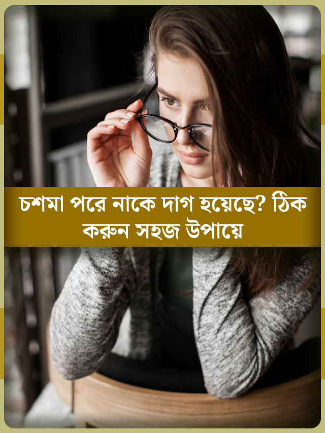 নিয়মিত চশমা পরে নাকের পাশে মোটা দাগ হয়েছে? দূর করুন এইভাবে নিয়মিত চশমা পরে নাকের পাশে মোটা দাগ হয়েছে? দূর করুন এইভাবে