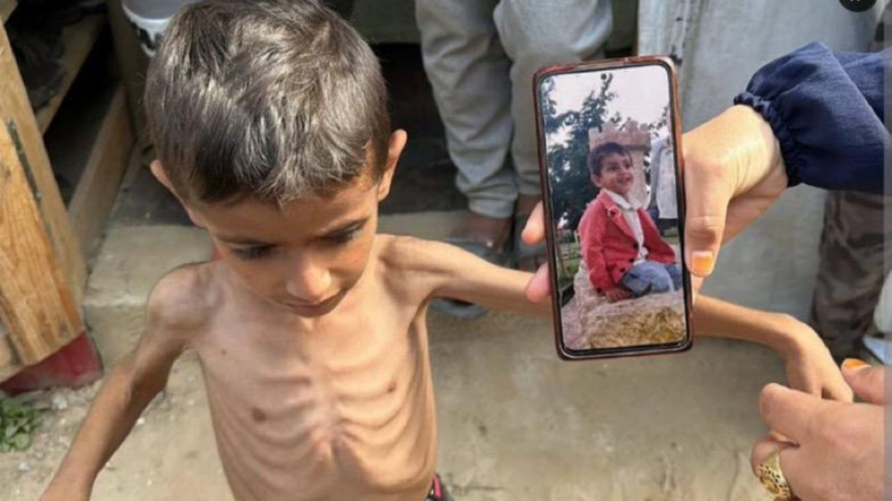 Gaza: 'যন্ত্রণায় কাঁদছে শিশুরা, ব্যথা কমানোর ওষুধও নেই', ভয়ঙ্কর ছবি গাজার Gaza: 'যন্ত্রণায় কাঁদছে শিশুরা, ব্যথা কমানোর ওষুধও নেই', ভয়ঙ্কর ছবি গাজার