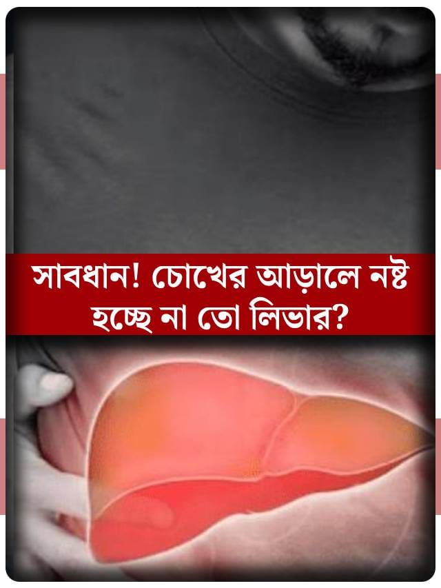 তলে তলে নষ্ট হচ্ছে না তো লিভার? কোন সাধারণ লক্ষণ দেখলে সাবধান হবেন? তলে তলে নষ্ট হচ্ছে না তো লিভার? কোন সাধারণ লক্ষণ দেখলে সাবধান হবেন?