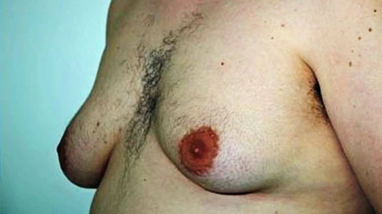 Male Breast Enlargement Explained: পুরুষদের বুবস কেন বাড়ে? মেল বুবস কী ভাবে নিয়ন্ত্রণ করবেন?