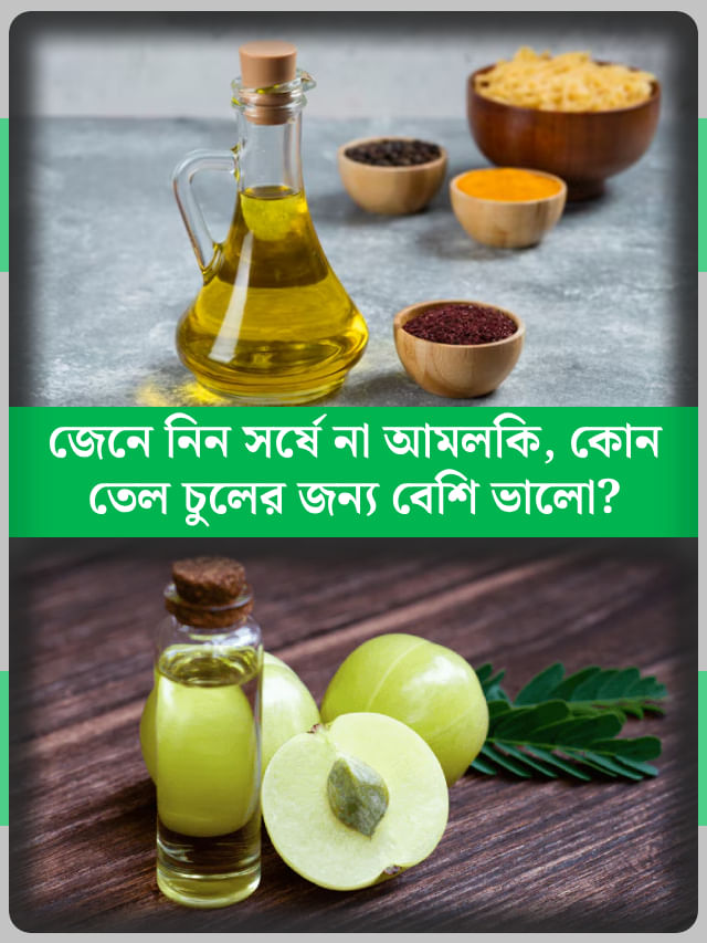 সর্ষে না আমলকি... কোন তেল চুলের জন্য সবচেয়ে বেশি উপকারী? সর্ষে না আমলকি... কোন তেল চুলের জন্য সবচেয়ে বেশি উপকারী?