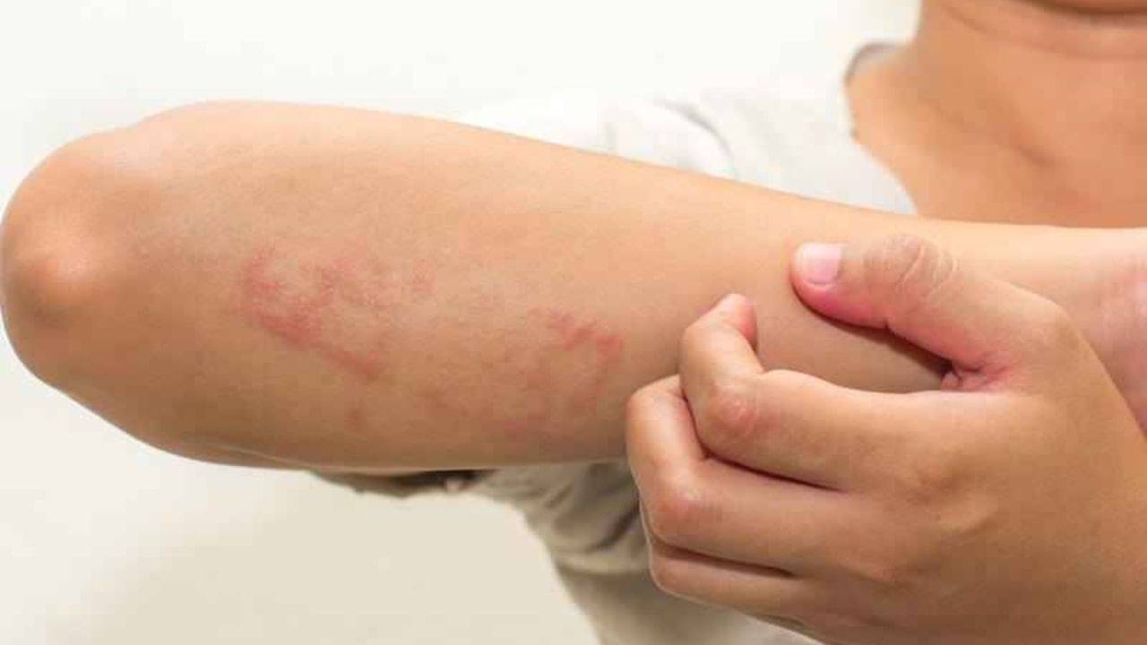 শরীরের ভিটামিন ডি ঘাটতি হচ্ছে, জানান দেয় আপনার ত্বক এবং পা! কী দেখলে সাবধান?