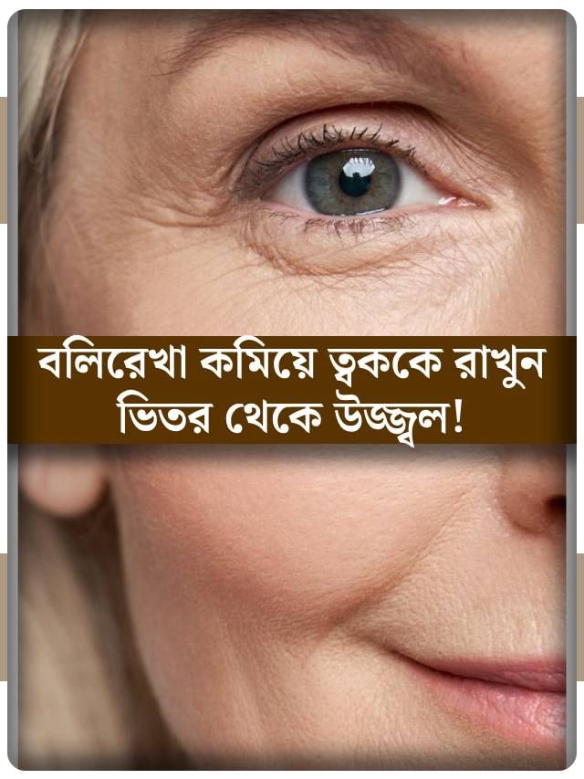 উধাও হবে বলিরেখা, ত্বক থাকবে টানটান, সুন্দর! শুধু পাতে রাখুন এই খাবার উধাও হবে বলিরেখা, ত্বক থাকবে টানটান, সুন্দর! শুধু পাতে রাখুন এই খাবার
